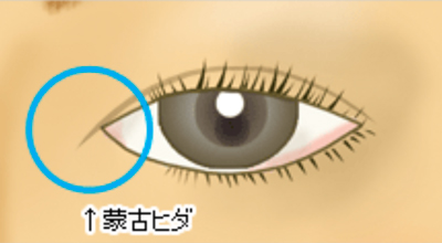 eye_3_megashira_1