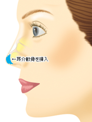 nose_1_nankotsu_2